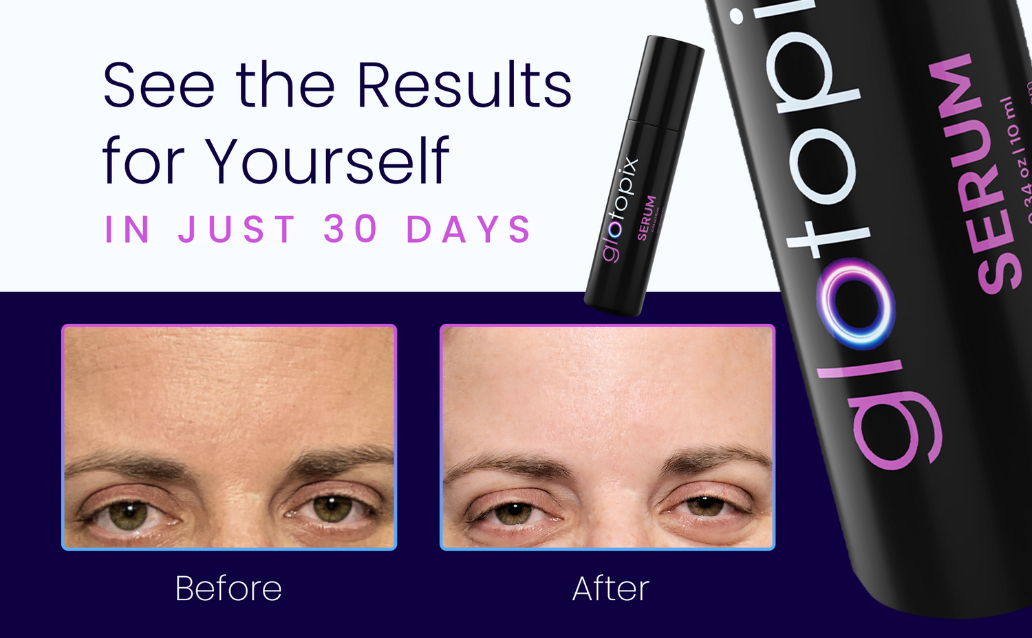 Glotopix⢠Serum Roller