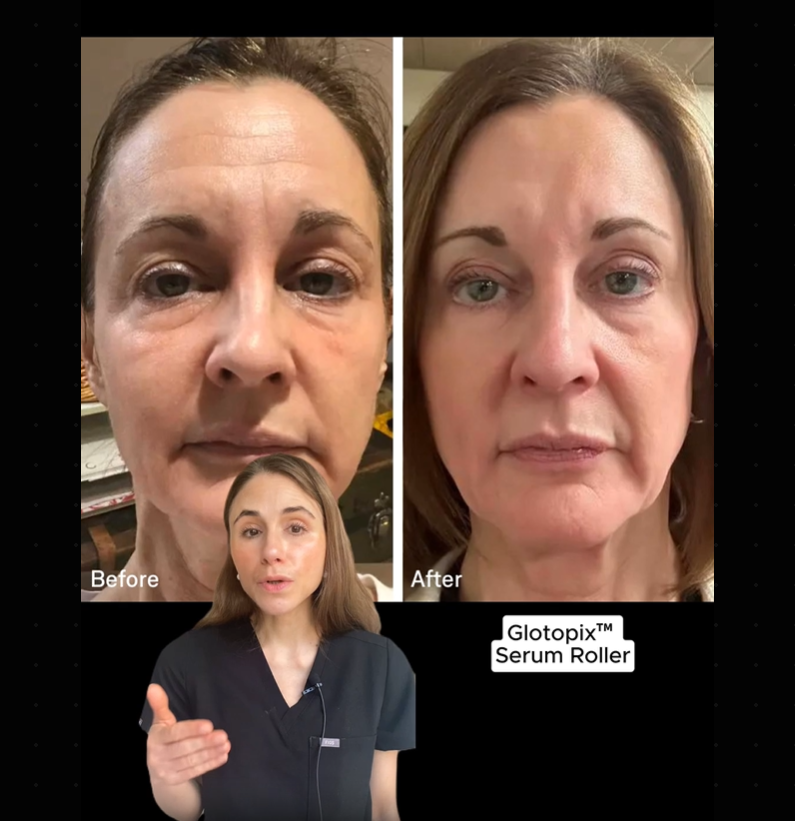 Load video: glotopix skincare story promo